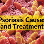 Managing chronic inflammation with psoriasis