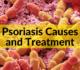 Managing chronic inflammation with psoriasis