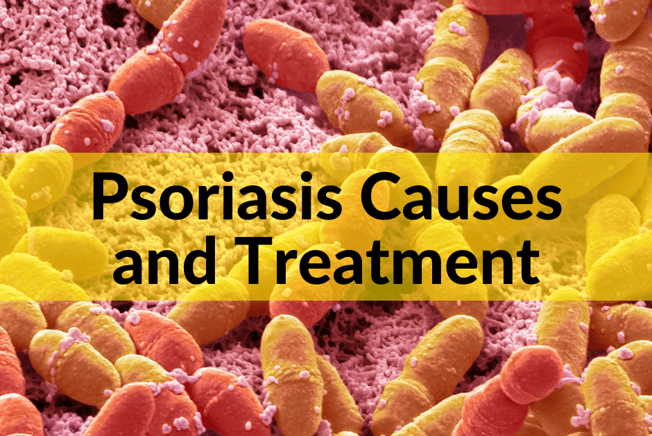 Managing chronic inflammation with psoriasis