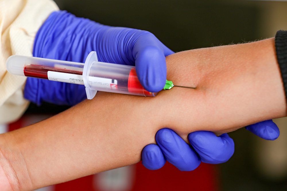 First blood test to help detect Alzheimer’s approved in the U.S.