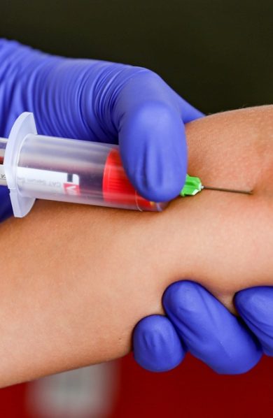 First blood test to help detect Alzheimer’s approved in the U.S.